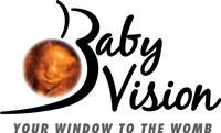 Baby Vision 4d ultrasound - Atlanta, Georgia